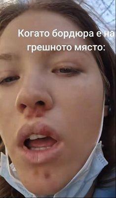Ергенка се претрепа на ски (ШОК СНИМКИ)